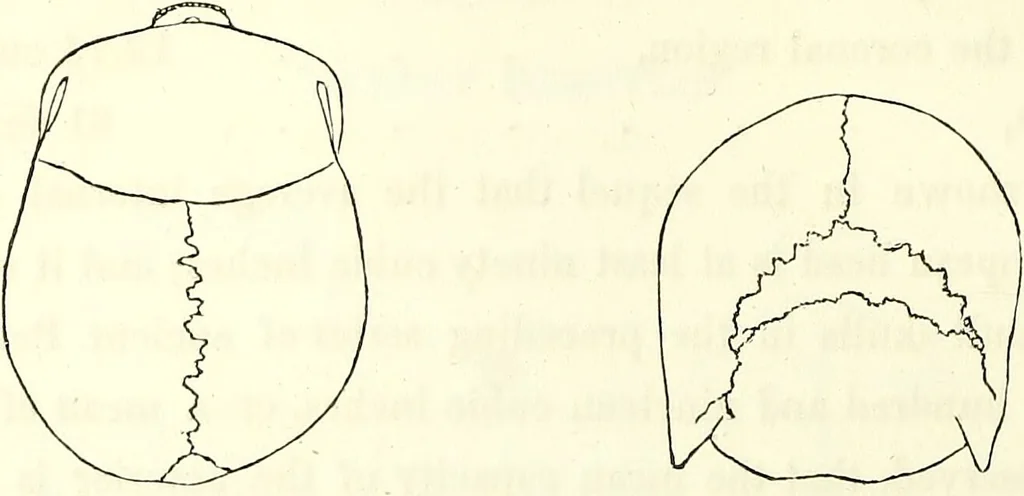 An illustration from Crania americana or, A comparative view of the skulls of various aboriginal nations of North and South America : to which is prefixed an essay on the varities of the human species / by Samuel George Morton., 1839, leaf 134