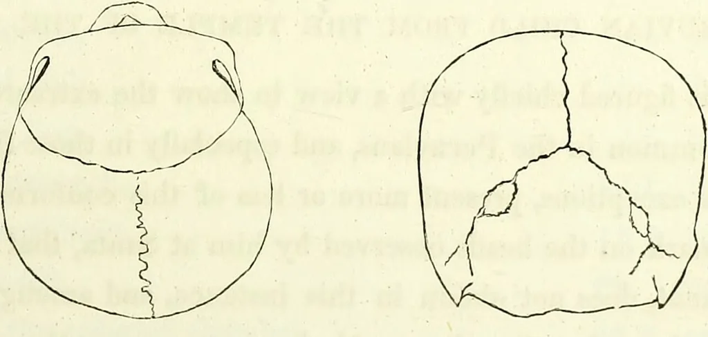 An illustration from Crania americana or, A comparative view of the skulls of various aboriginal nations of North and South America : to which is prefixed an essay on the varities of the human species / by Samuel George Morton., 1839, leaf 147