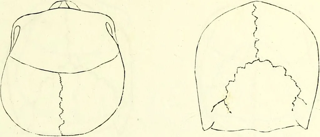An illustration from Crania americana or, A comparative view of the skulls of various aboriginal nations of North and South America : to which is prefixed an essay on the varities of the human species / by Samuel George Morton., 1839, leaf 149