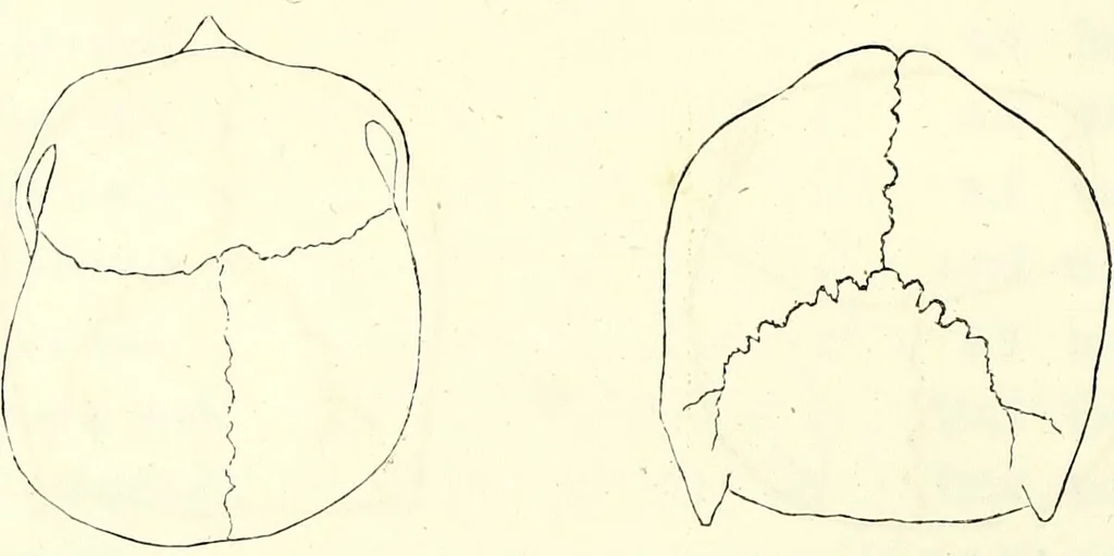 An illustration from Crania americana or, A comparative view of the skulls of various aboriginal nations of North and South America : to which is prefixed an essay on the varities of the human species / by Samuel George Morton., 1839, leaf 150
