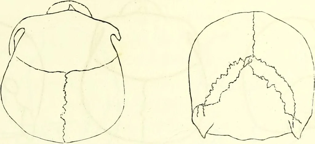 An illustration from Crania americana or, A comparative view of the skulls of various aboriginal nations of North and South America : to which is prefixed an essay on the varities of the human species / by Samuel George Morton., 1839, leaf 151
