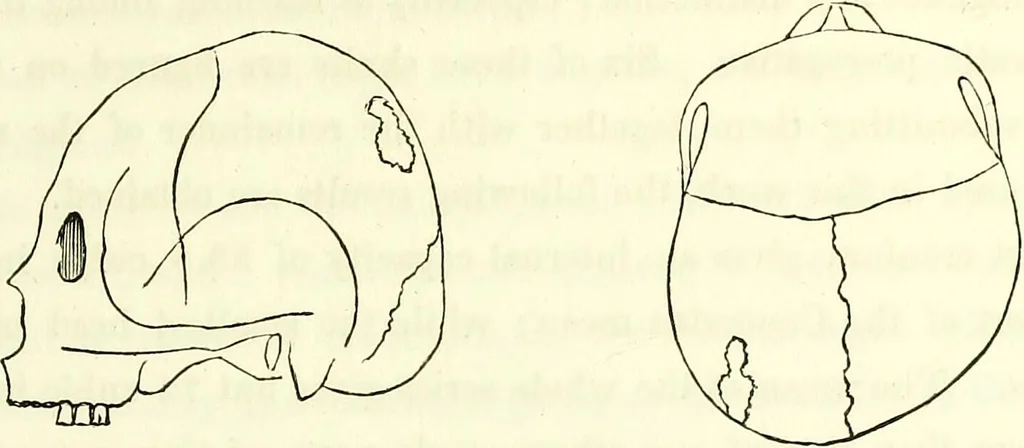 An illustration from Crania americana or, A comparative view of the skulls of various aboriginal nations of North and South America : to which is prefixed an essay on the varities of the human species / by Samuel George Morton., 1839, leaf 153
