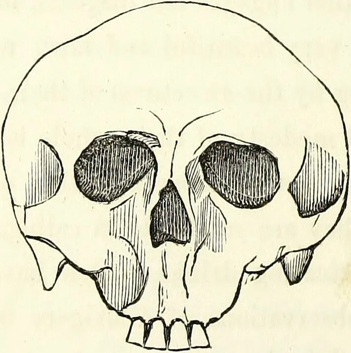An illustration from Crania americana or, A comparative view of the skulls of various aboriginal nations of North and South America : to which is prefixed an essay on the varities of the human species / by Samuel George Morton., 1839, leaf 166