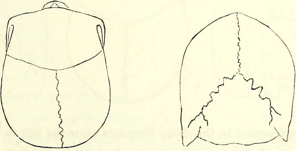 An illustration from Crania americana or, A comparative view of the skulls of various aboriginal nations of North and South America : to which is prefixed an essay on the varities of the human species / by Samuel George Morton., 1839, leaf 175