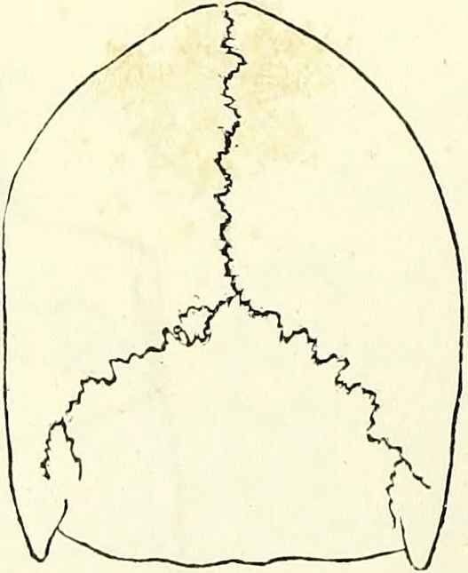 An illustration from Crania americana or, A comparative view of the skulls of various aboriginal nations of North and South America : to which is prefixed an essay on the varities of the human species / by Samuel George Morton., 1839, leaf 176