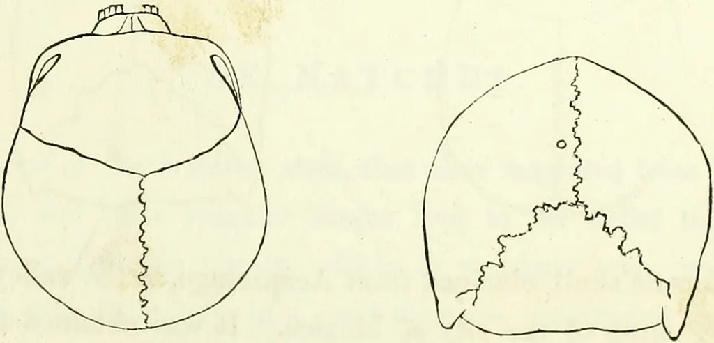 An illustration from Crania americana or, A comparative view of the skulls of various aboriginal nations of North and South America : to which is prefixed an essay on the varities of the human species / by Samuel George Morton., 1839, leaf 177
