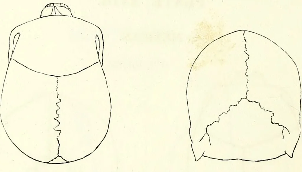 An illustration from Crania americana or, A comparative view of the skulls of various aboriginal nations of North and South America : to which is prefixed an essay on the varities of the human species / by Samuel George Morton., 1839, leaf 178