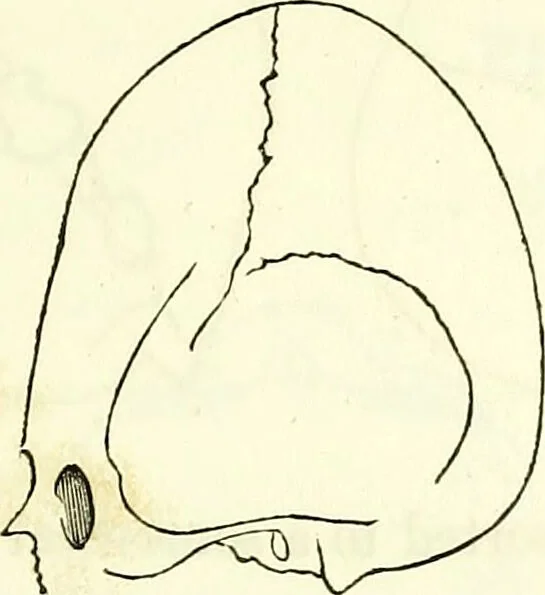 An illustration from Crania americana or, A comparative view of the skulls of various aboriginal nations of North and South America : to which is prefixed an essay on the varities of the human species / by Samuel George Morton., 1839, leaf 183