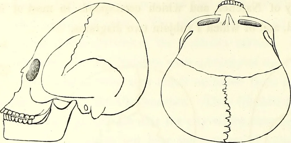 An illustration from Crania americana or, A comparative view of the skulls of various aboriginal nations of North and South America : to which is prefixed an essay on the varities of the human species / by Samuel George Morton., 1839, leaf 184