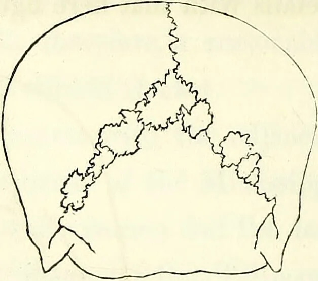 An illustration from Crania americana or, A comparative view of the skulls of various aboriginal nations of North and South America : to which is prefixed an essay on the varities of the human species / by Samuel George Morton., 1839, leaf 184