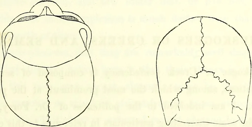 An illustration from Crania americana or, A comparative view of the skulls of various aboriginal nations of North and South America : to which is prefixed an essay on the varities of the human species / by Samuel George Morton., 1839, leaf 185