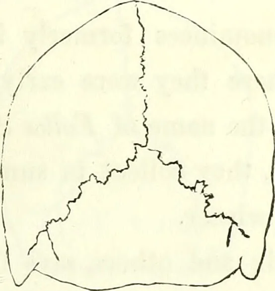An illustration from Crania americana or, A comparative view of the skulls of various aboriginal nations of North and South America : to which is prefixed an essay on the varities of the human species / by Samuel George Morton., 1839, leaf 199