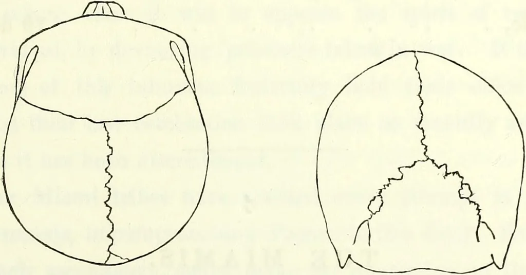 An illustration from Crania americana or, A comparative view of the skulls of various aboriginal nations of North and South America : to which is prefixed an essay on the varities of the human species / by Samuel George Morton., 1839, leaf 201