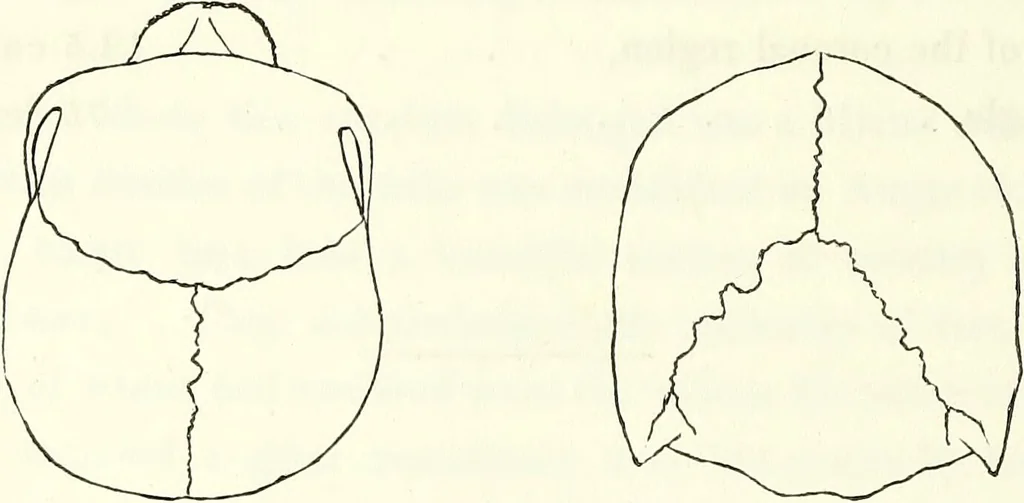 An illustration from Crania americana or, A comparative view of the skulls of various aboriginal nations of North and South America : to which is prefixed an essay on the varities of the human species / by Samuel George Morton., 1839, leaf 206