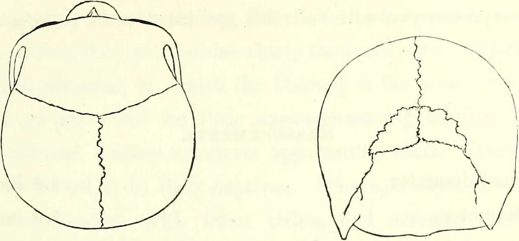 An illustration from Crania americana or, A comparative view of the skulls of various aboriginal nations of North and South America : to which is prefixed an essay on the varities of the human species / by Samuel George Morton., 1839, leaf 221
