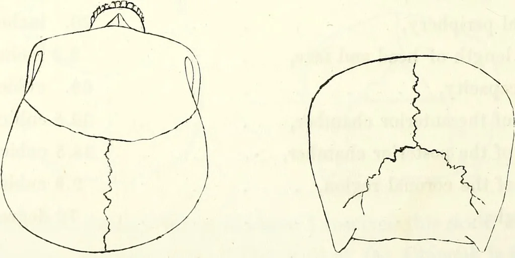 An illustration from Crania americana or, A comparative view of the skulls of various aboriginal nations of North and South America : to which is prefixed an essay on the varities of the human species / by Samuel George Morton., 1839, leaf 232