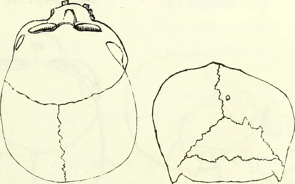 An illustration from Crania americana or, A comparative view of the skulls of various aboriginal nations of North and South America : to which is prefixed an essay on the varities of the human species / by Samuel George Morton., 1839, leaf 233