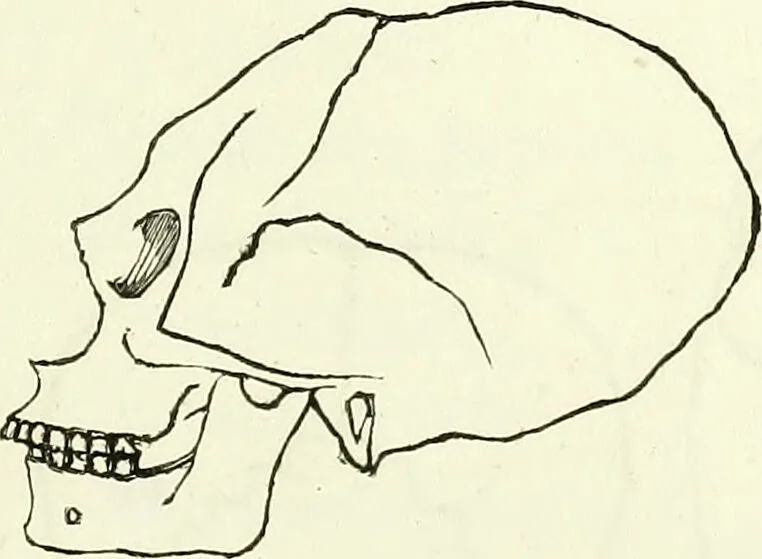 An illustration from Crania americana or, A comparative view of the skulls of various aboriginal nations of North and South America : to which is prefixed an essay on the varities of the human species / by Samuel George Morton., 1839, leaf 233
