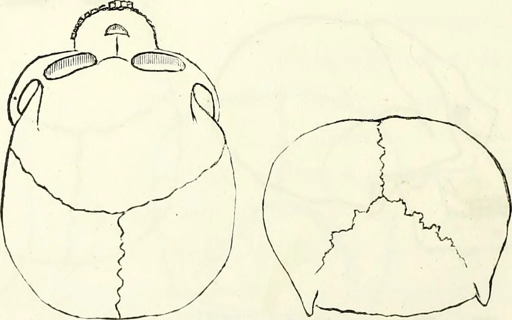 An illustration from Crania americana or, A comparative view of the skulls of various aboriginal nations of North and South America : to which is prefixed an essay on the varities of the human species / by Samuel George Morton., 1839, leaf 234