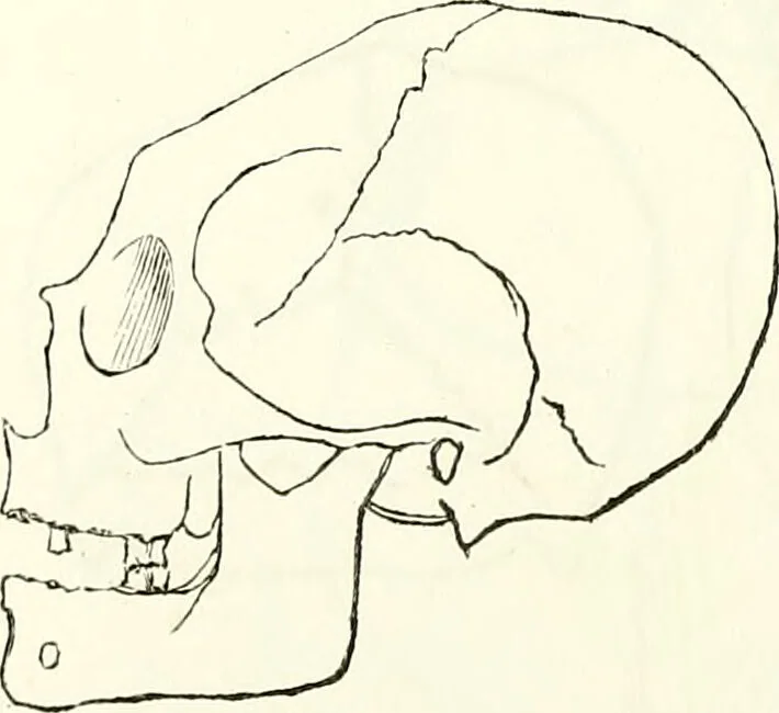 An illustration from Crania americana or, A comparative view of the skulls of various aboriginal nations of North and South America : to which is prefixed an essay on the varities of the human species / by Samuel George Morton., 1839, leaf 234