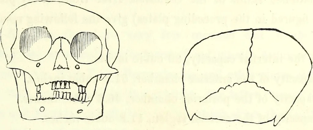 An illustration from Crania americana or, A comparative view of the skulls of various aboriginal nations of North and South America : to which is prefixed an essay on the varities of the human species / by Samuel George Morton., 1839, leaf 237