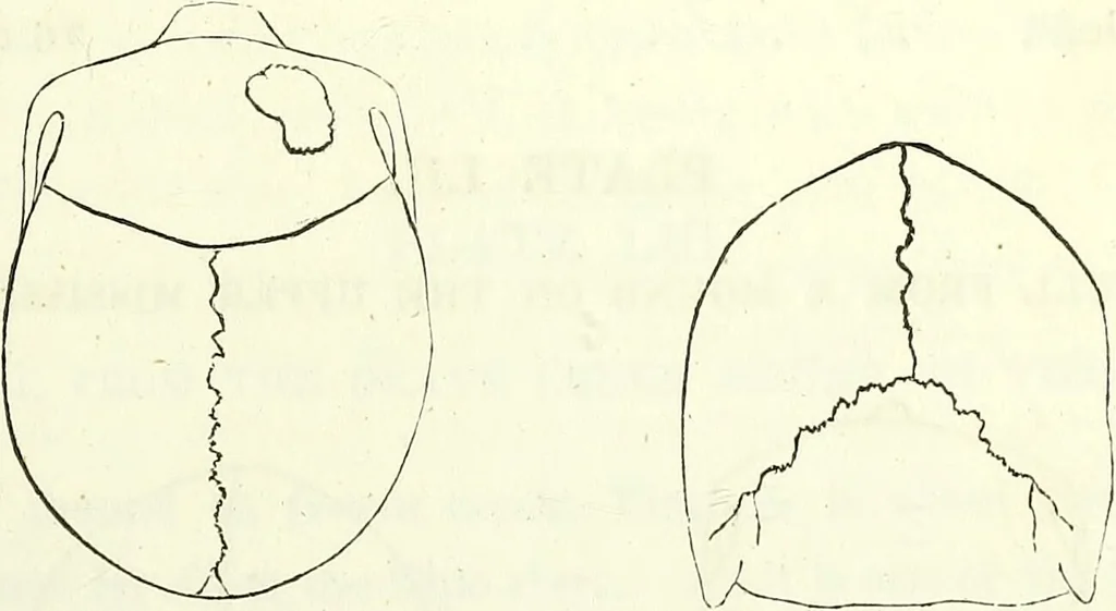 An illustration from Crania americana or, A comparative view of the skulls of various aboriginal nations of North and South America : to which is prefixed an essay on the varities of the human species / by Samuel George Morton., 1839, leaf 241