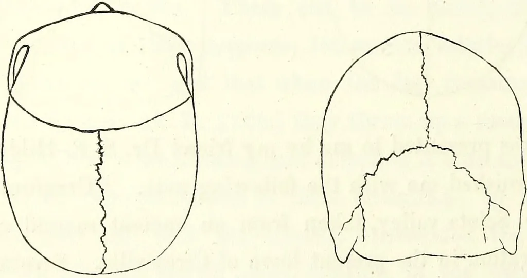 An illustration from Crania americana or, A comparative view of the skulls of various aboriginal nations of North and South America : to which is prefixed an essay on the varities of the human species / by Samuel George Morton., 1839, leaf 242