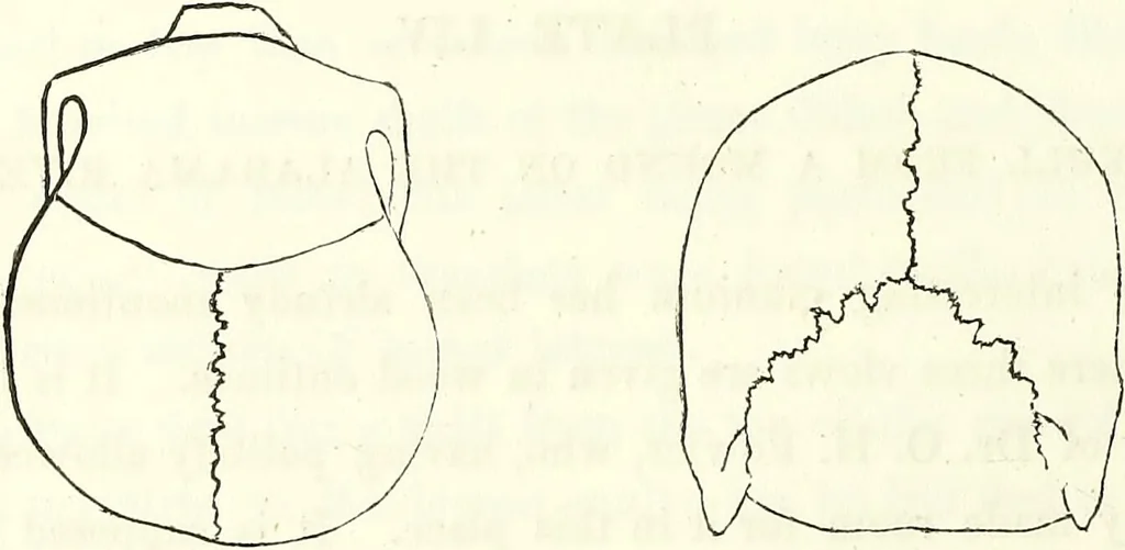 An illustration from Crania americana or, A comparative view of the skulls of various aboriginal nations of North and South America : to which is prefixed an essay on the varities of the human species / by Samuel George Morton., 1839, leaf 246