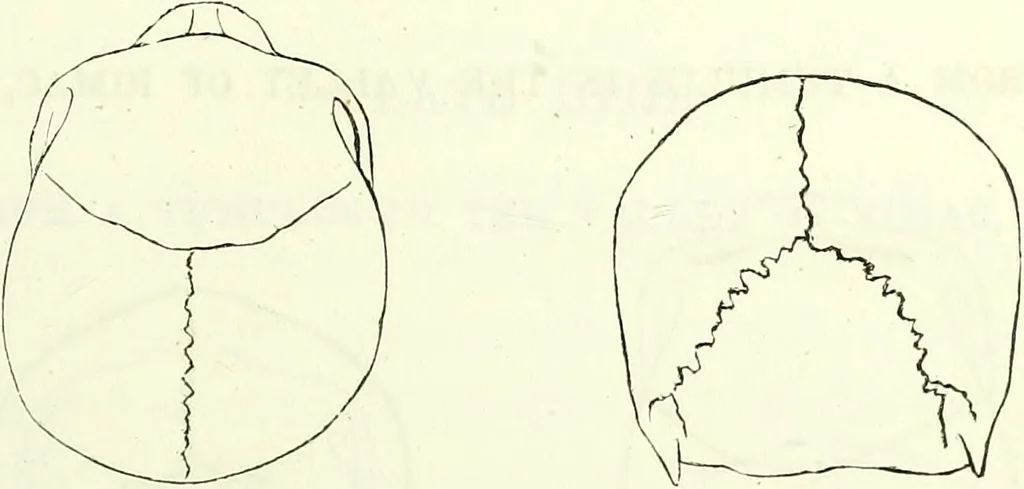An illustration from Crania americana or, A comparative view of the skulls of various aboriginal nations of North and South America : to which is prefixed an essay on the varities of the human species / by Samuel George Morton., 1839, leaf 247