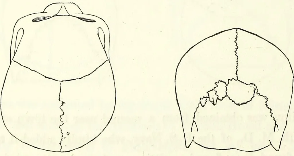 An illustration from Crania americana or, A comparative view of the skulls of various aboriginal nations of North and South America : to which is prefixed an essay on the varities of the human species / by Samuel George Morton., 1839, leaf 248