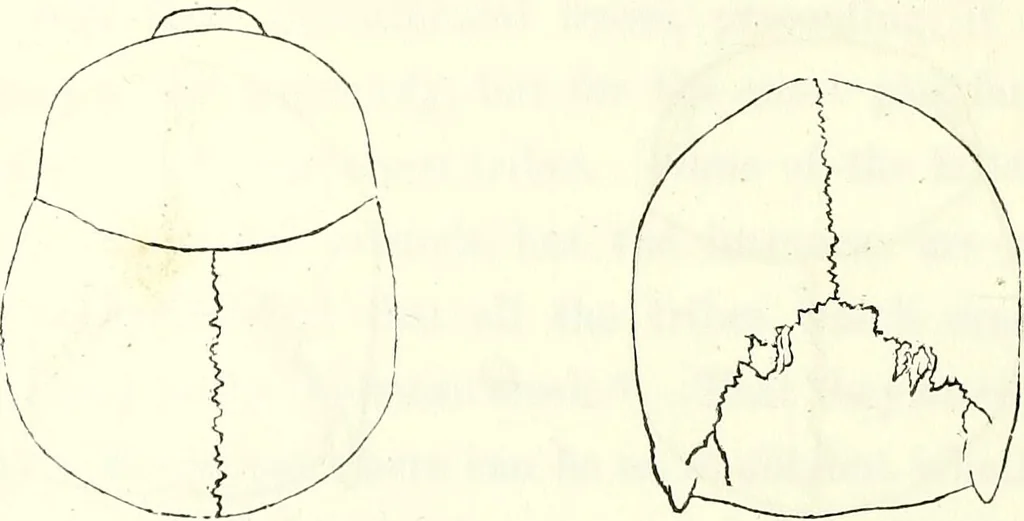An illustration from Crania americana or, A comparative view of the skulls of various aboriginal nations of North and South America : to which is prefixed an essay on the varities of the human species / by Samuel George Morton., 1839, leaf 254