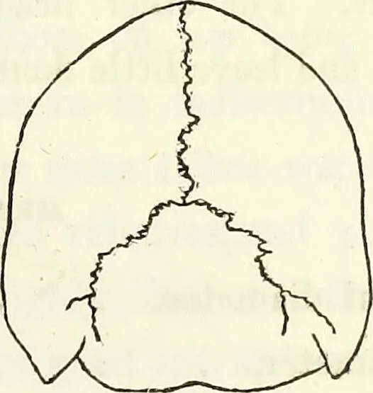 An illustration from Crania americana or, A comparative view of the skulls of various aboriginal nations of North and South America : to which is prefixed an essay on the varities of the human species / by Samuel George Morton., 1839, leaf 255