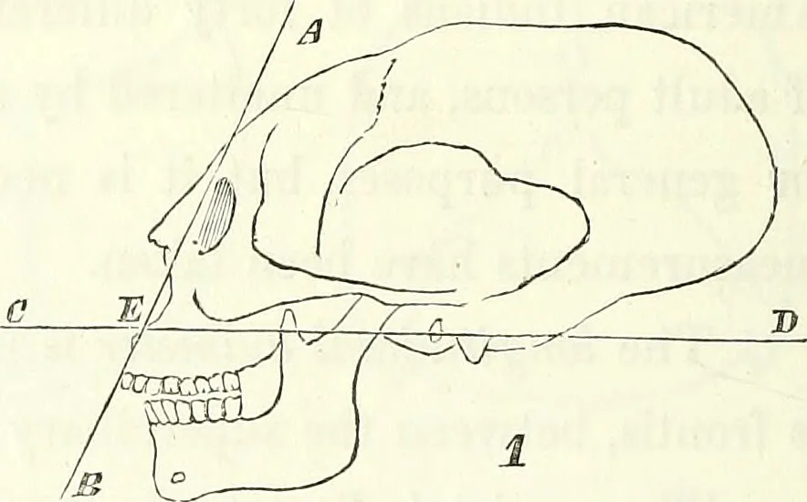 An illustration from Crania americana or, A comparative view of the skulls of various aboriginal nations of North and South America : to which is prefixed an essay on the varities of the human species / by Samuel George Morton., 1839, leaf 272