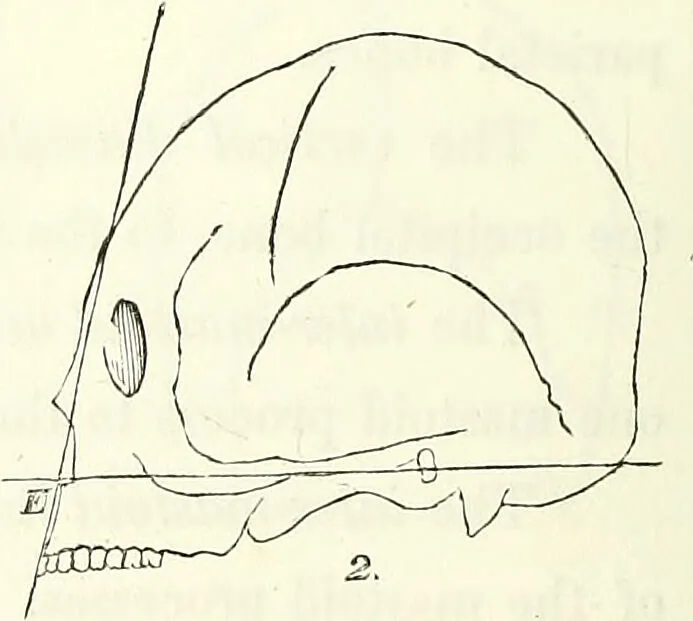 An illustration from Crania americana or, A comparative view of the skulls of various aboriginal nations of North and South America : to which is prefixed an essay on the varities of the human species / by Samuel George Morton., 1839, leaf 272