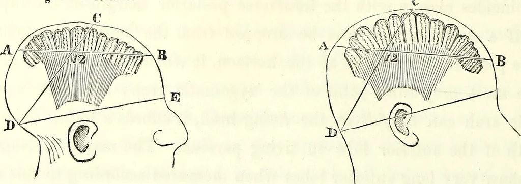 An illustration from Crania americana or, A comparative view of the skulls of various aboriginal nations of North and South America : to which is prefixed an essay on the varities of the human species / by Samuel George Morton., 1839, leaf 302