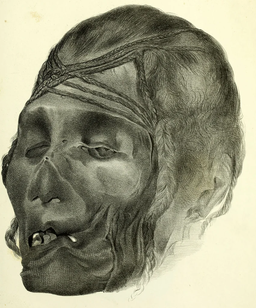 An illustration from Crania americana or, A comparative view of the skulls of various aboriginal nations of North and South America : to which is prefixed an essay on the varities of the human species / by Samuel George Morton., 1839, leaf 319