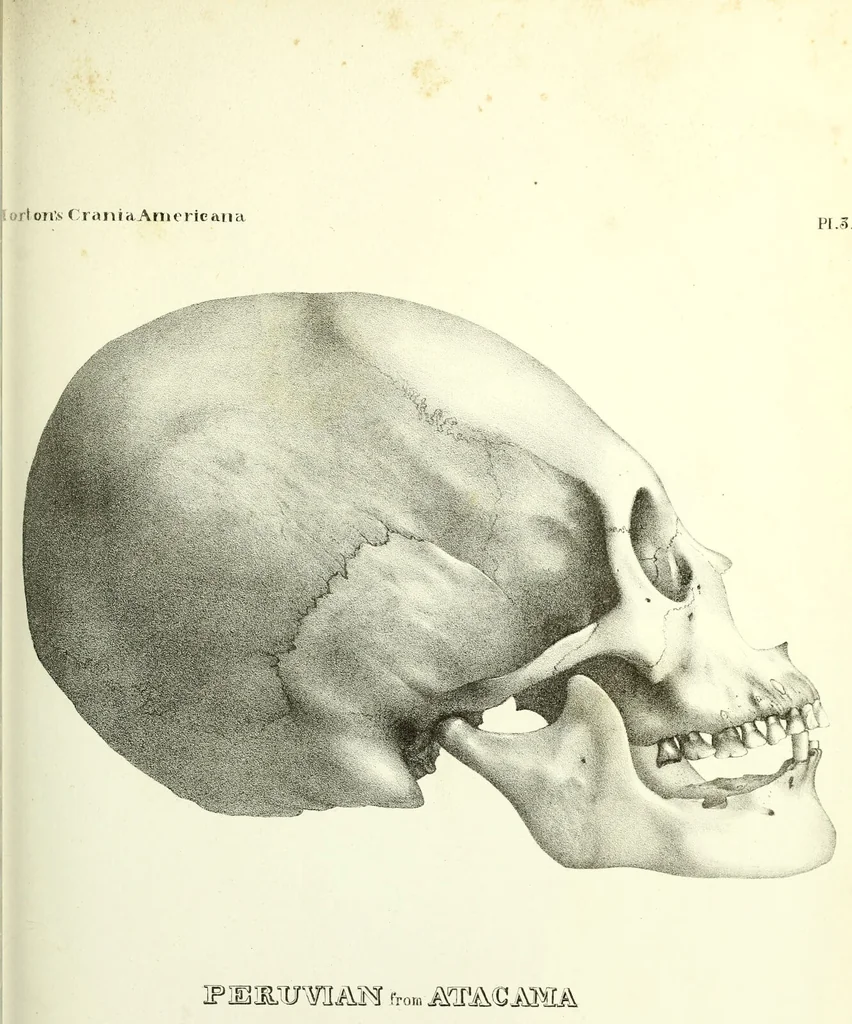 An illustration from Crania americana or, A comparative view of the skulls of various aboriginal nations of North and South America : to which is prefixed an essay on the varities of the human species / by Samuel George Morton., 1839, leaf 323