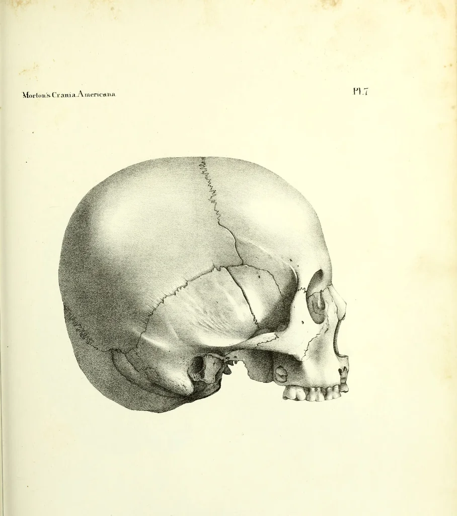 An illustration from Crania americana or, A comparative view of the skulls of various aboriginal nations of North and South America : to which is prefixed an essay on the varities of the human species / by Samuel George Morton., 1839, leaf 331
