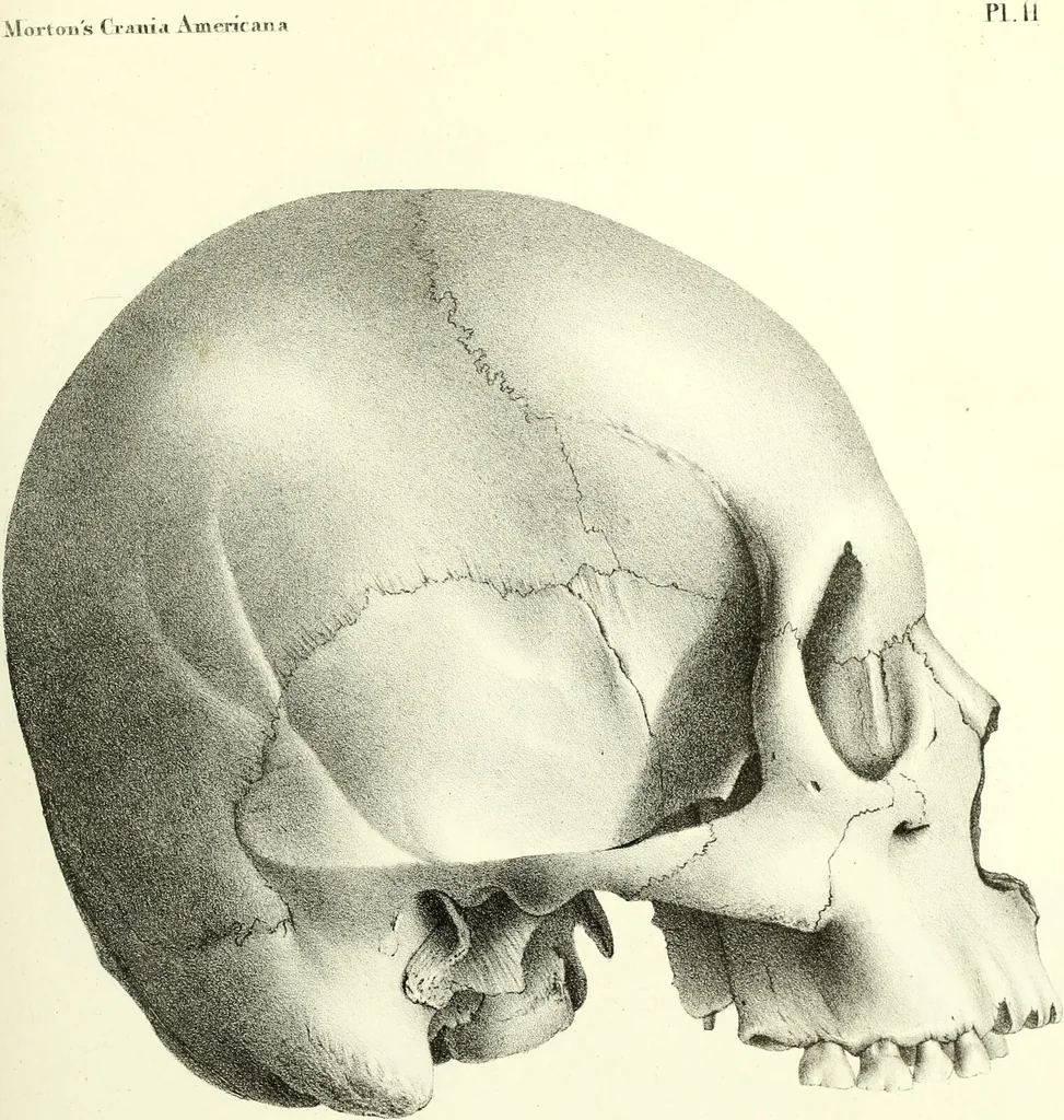 An illustration from Crania americana or, A comparative view of the skulls of various aboriginal nations of North and South America : to which is prefixed an essay on the varities of the human species / by Samuel George Morton., 1839, leaf 339
