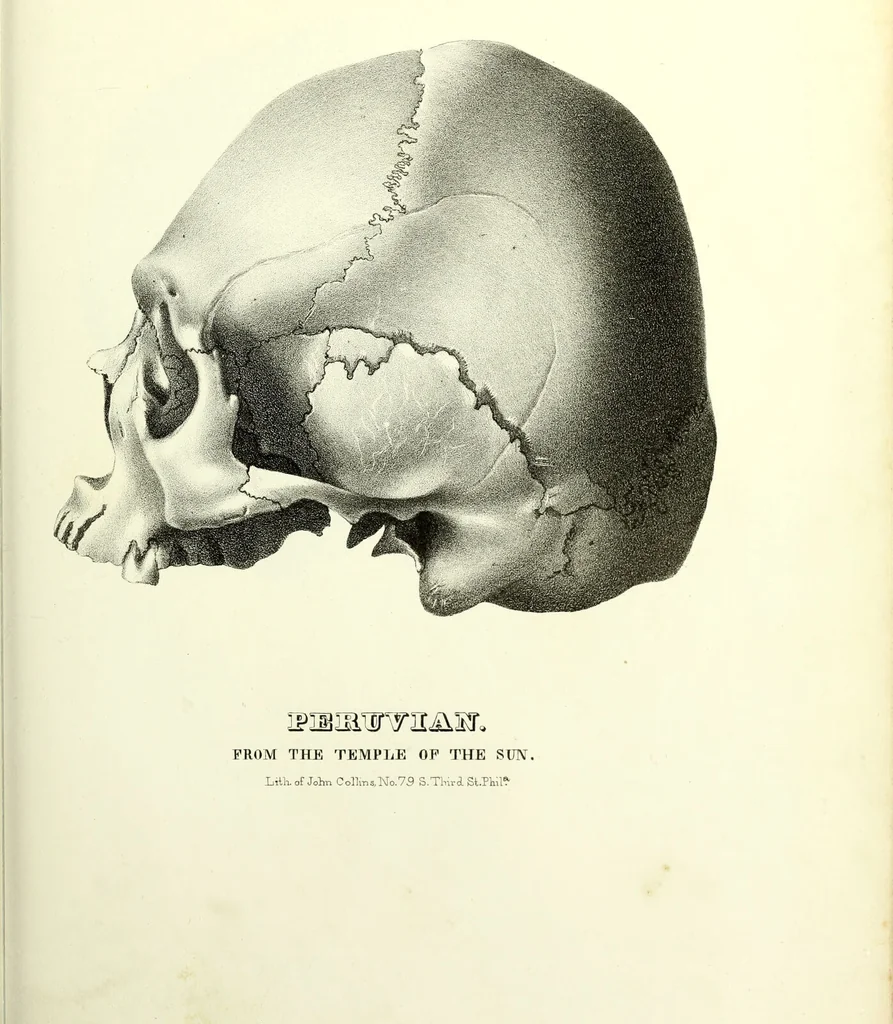 An illustration from Crania americana or, A comparative view of the skulls of various aboriginal nations of North and South America : to which is prefixed an essay on the varities of the human species / by Samuel George Morton., 1839, leaf 343