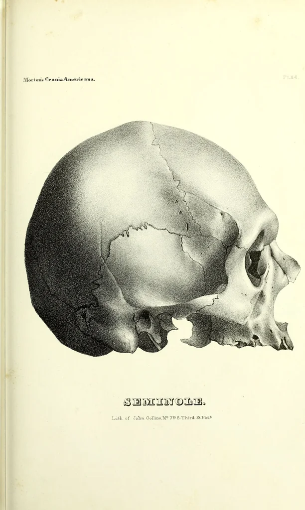 An illustration from Crania americana or, A comparative view of the skulls of various aboriginal nations of North and South America : to which is prefixed an essay on the varities of the human species / by Samuel George Morton., 1839, leaf 377