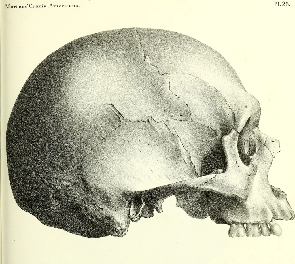 An illustration from Crania americana or, A comparative view of the skulls of various aboriginal nations of North and South America : to which is prefixed an essay on the varities of the human species / by Samuel George Morton., 1839, leaf 379