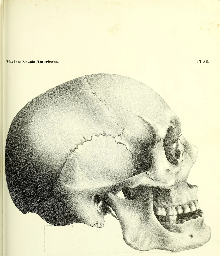 An illustration from Crania americana or, A comparative view of the skulls of various aboriginal nations of North and South America : to which is prefixed an essay on the varities of the human species / by Samuel George Morton., 1839, leaf 385