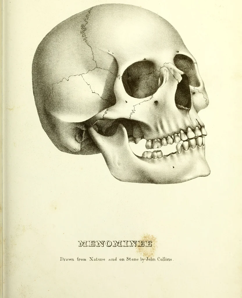 An illustration from Crania americana or, A comparative view of the skulls of various aboriginal nations of North and South America : to which is prefixed an essay on the varities of the human species / by Samuel George Morton., 1839, leaf 387