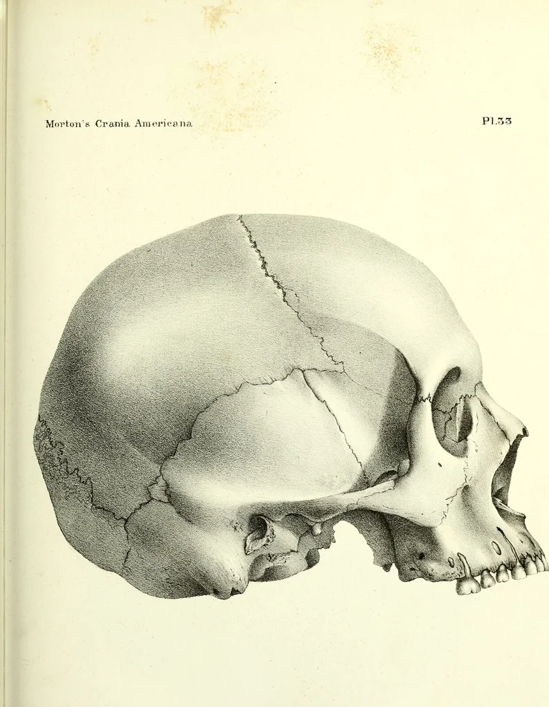 An illustration from Crania americana or, A comparative view of the skulls of various aboriginal nations of North and South America : to which is prefixed an essay on the varities of the human species / by Samuel George Morton., 1839, leaf 395