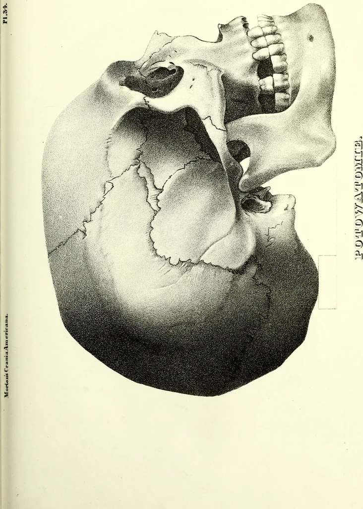 An illustration from Crania americana or, A comparative view of the skulls of various aboriginal nations of North and South America : to which is prefixed an essay on the varities of the human species / by Samuel George Morton., 1839, leaf 397