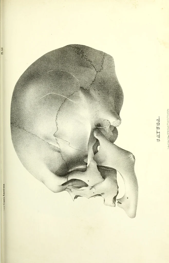 An illustration from Crania americana or, A comparative view of the skulls of various aboriginal nations of North and South America : to which is prefixed an essay on the varities of the human species / by Samuel George Morton., 1839, leaf 399