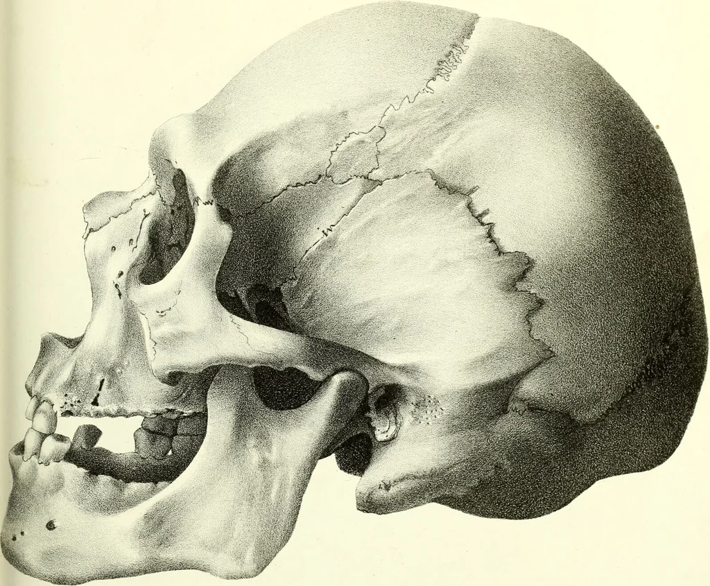 An illustration from Crania americana or, A comparative view of the skulls of various aboriginal nations of North and South America : to which is prefixed an essay on the varities of the human species / by Samuel George Morton., 1839, leaf 403