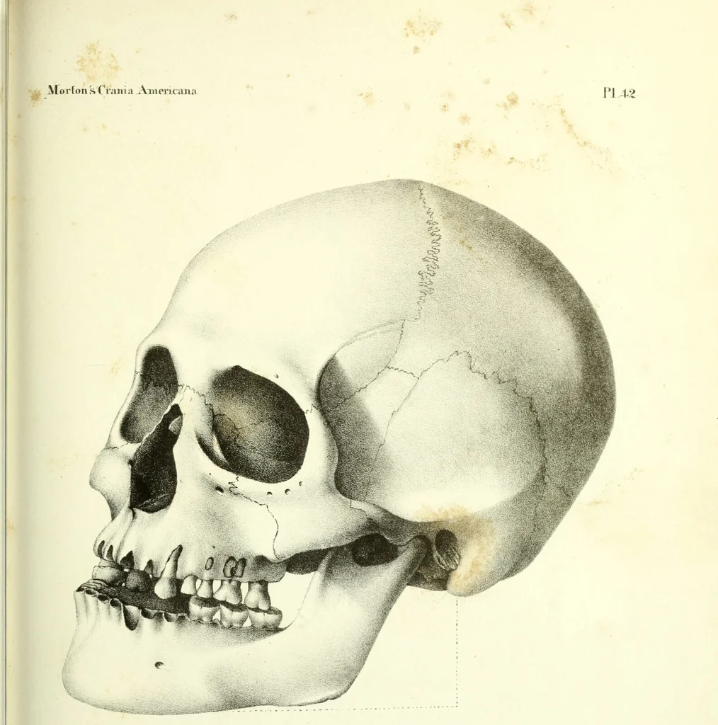 An illustration from Crania americana or, A comparative view of the skulls of various aboriginal nations of North and South America : to which is prefixed an essay on the varities of the human species / by Samuel George Morton., 1839, leaf 413