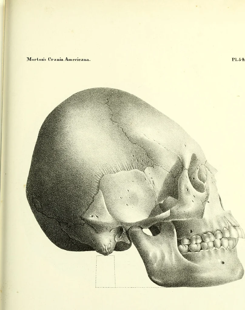 An illustration from Crania americana or, A comparative view of the skulls of various aboriginal nations of North and South America : to which is prefixed an essay on the varities of the human species / by Samuel George Morton., 1839, leaf 437